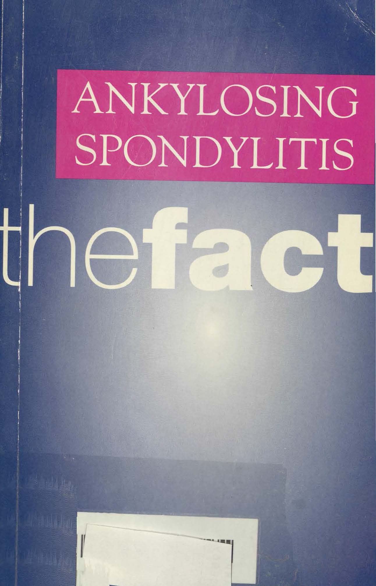 Ankylosing spondylitis 